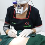 Treatment of body hair transplant at Hair Transplant Centre